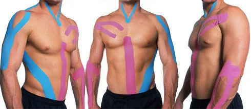 Kinesiology Taping