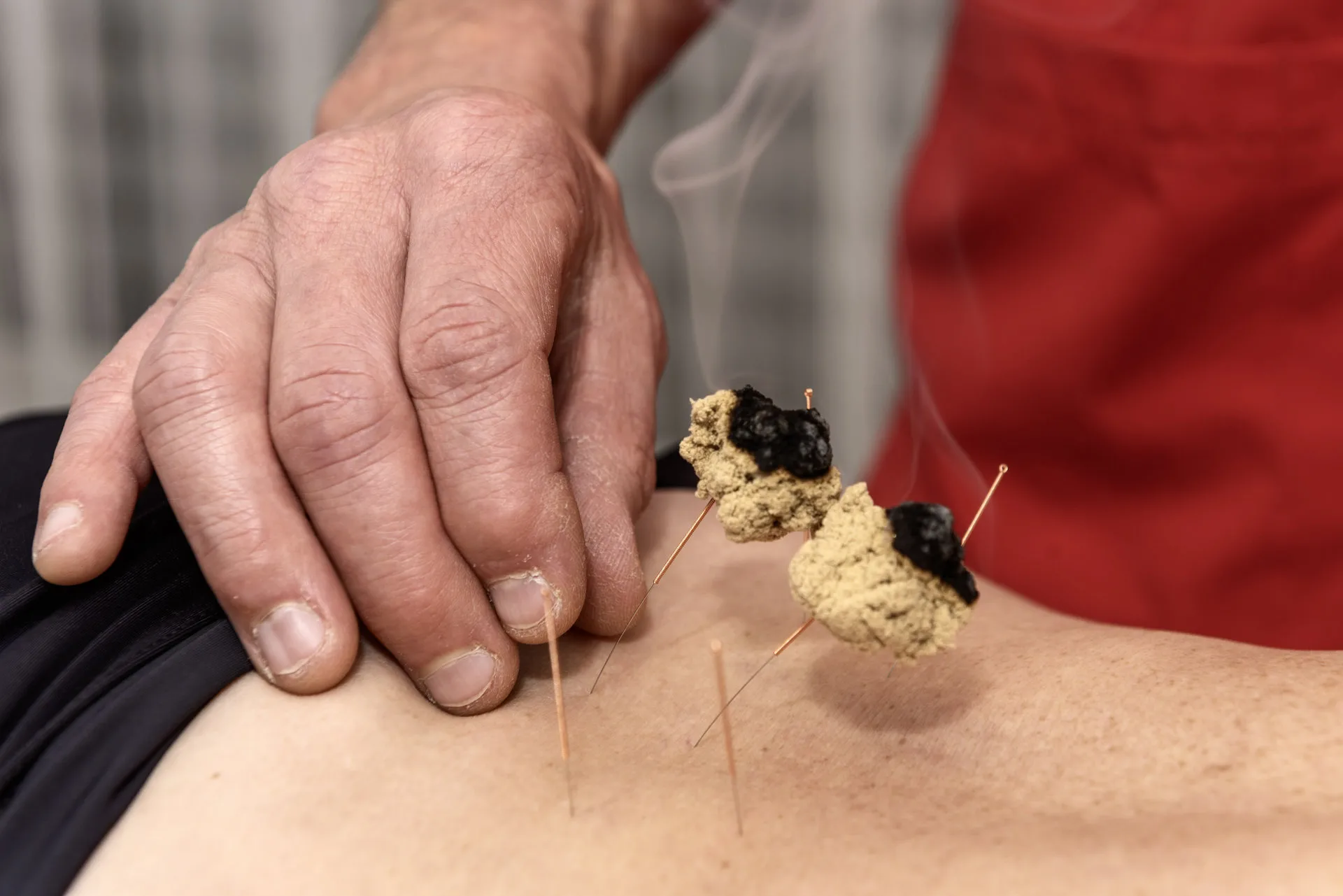 Médecine traditionnelle chinoise (MTC)